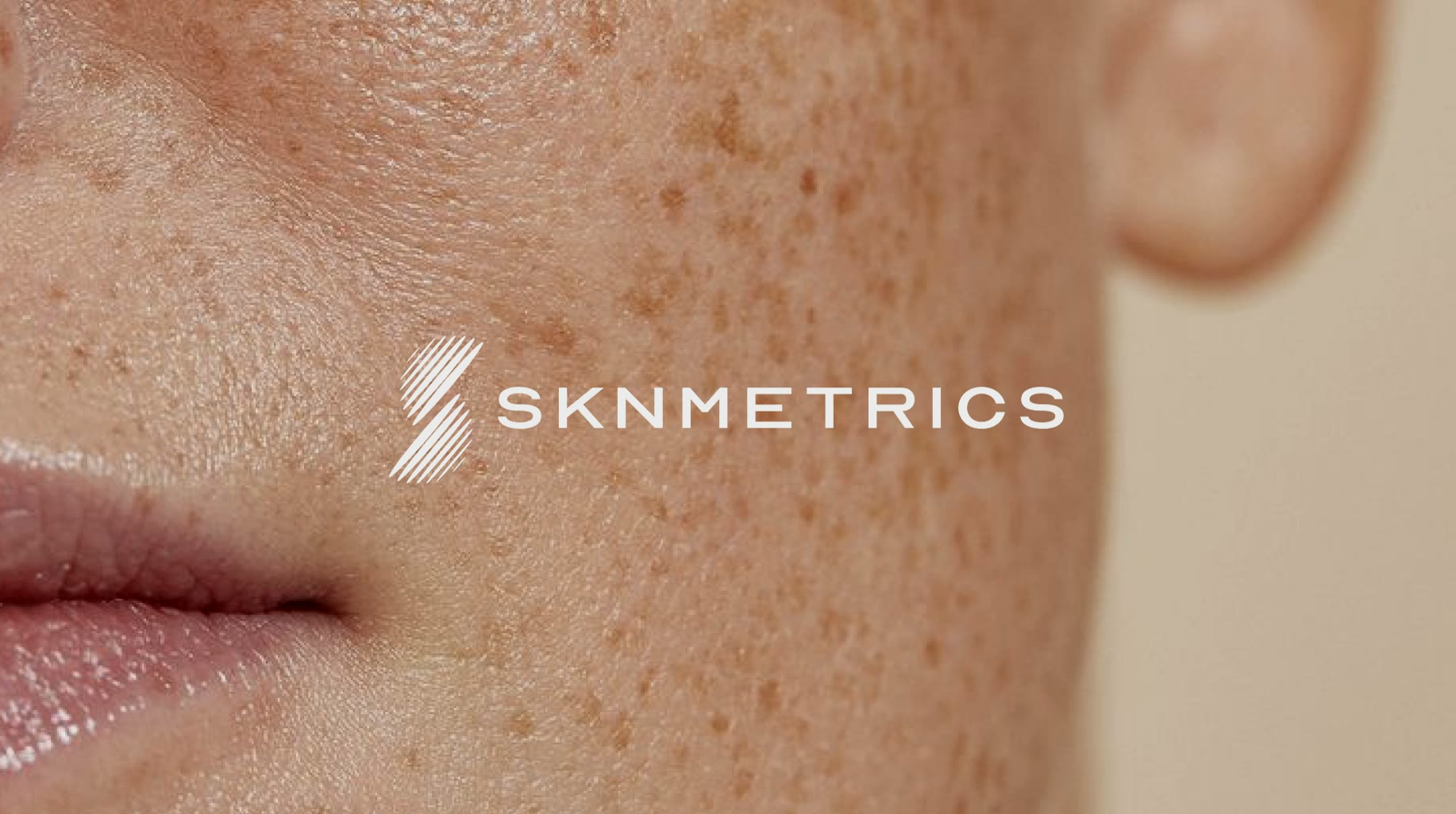 SKNMETRICS, Logo auf Hautnahaufnahme
